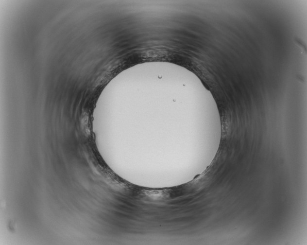 X0000099510187200806051156