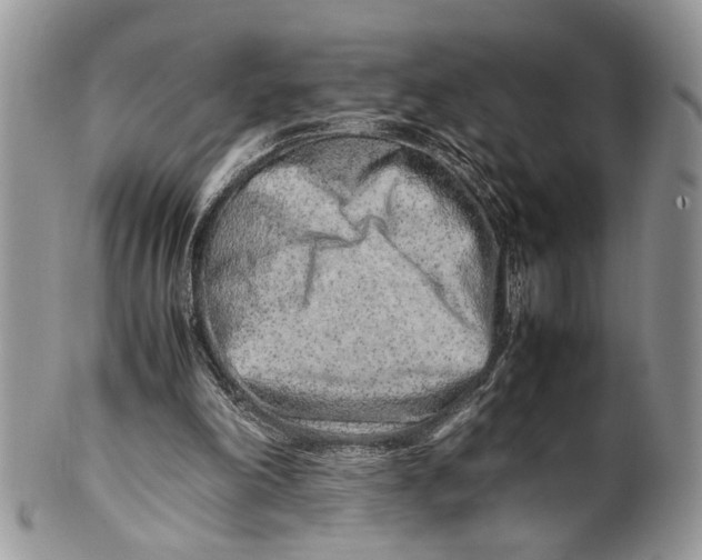 X0000099510198200806051155