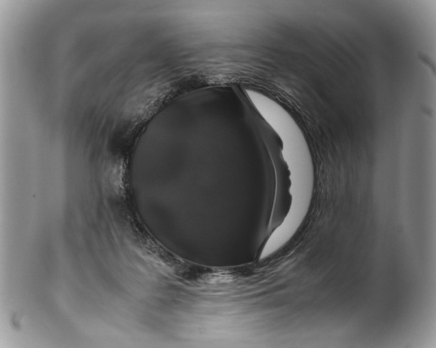 X0000099510219200806051155