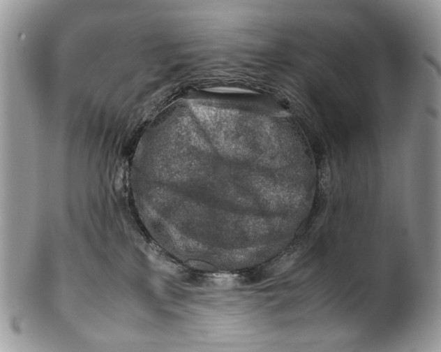 X0000099510233200806051154