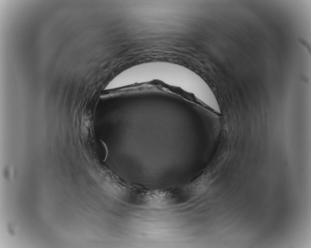 X0000099510235200806051154