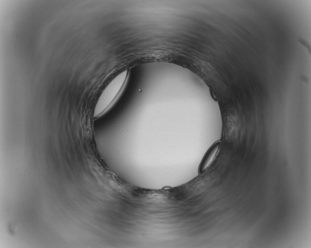 X0000099510236200806051154