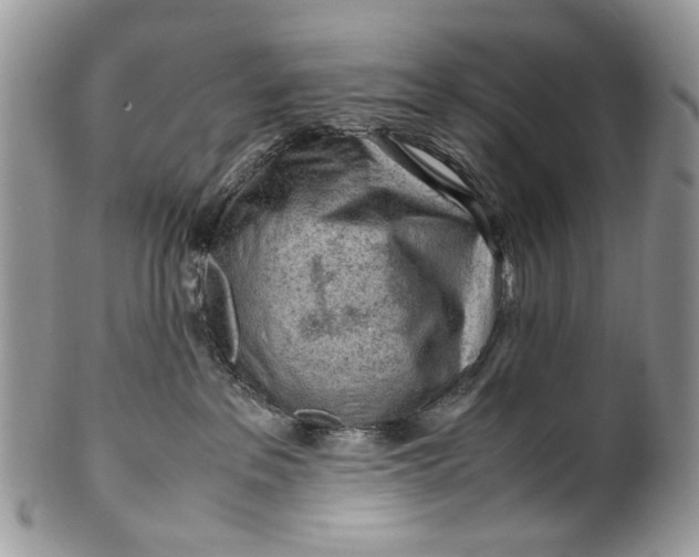 X0000099510237200806051154