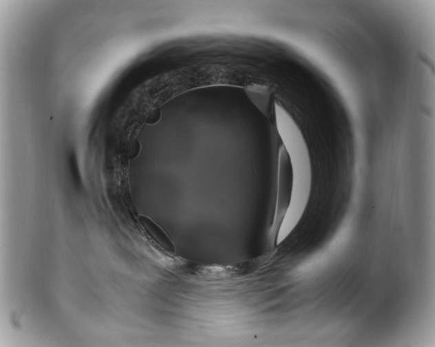 X0000099510239200806051154