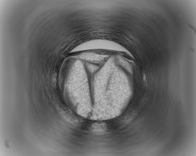 X0000099510271200806051154