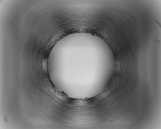 X0000099510286200806051154