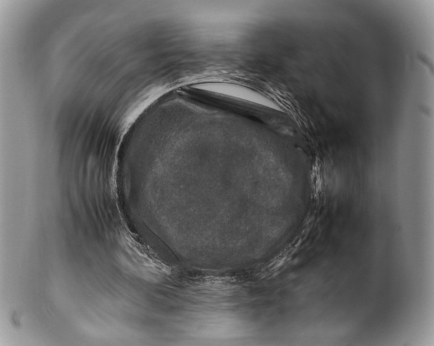 X0000099510292200806051154