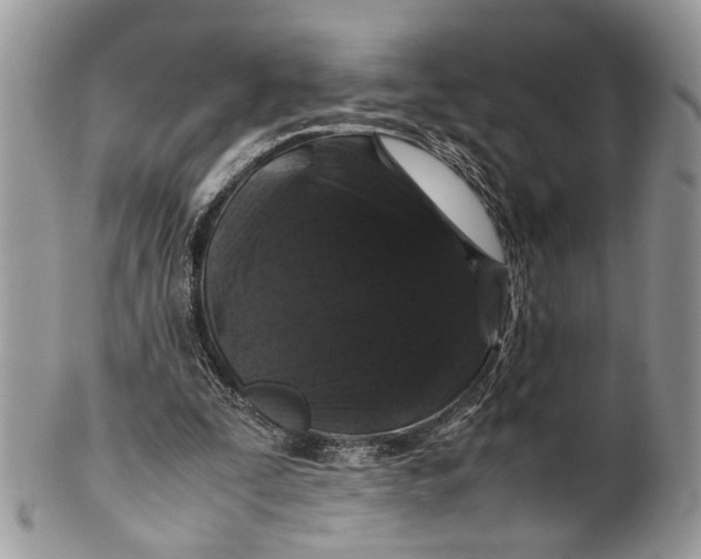 X0000099510295200806051154