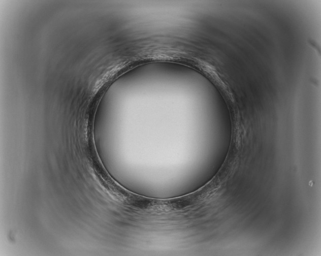 X0000099510299200806051153