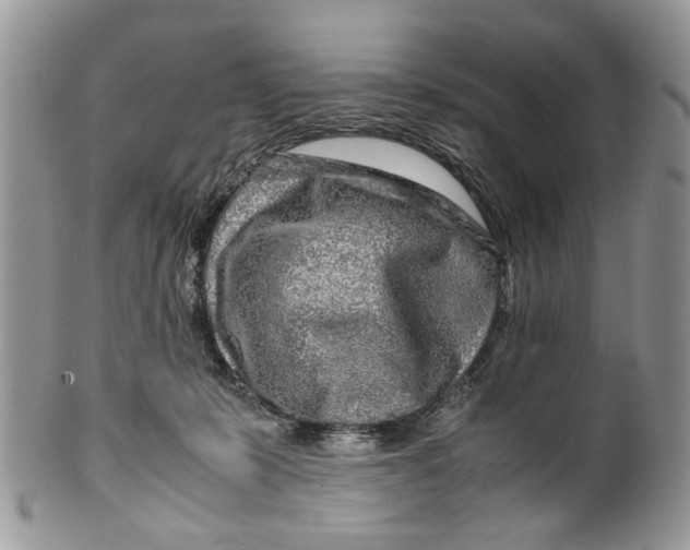 X0000099510319200806051153