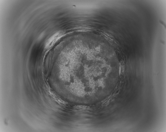 X0000099510339200806051152