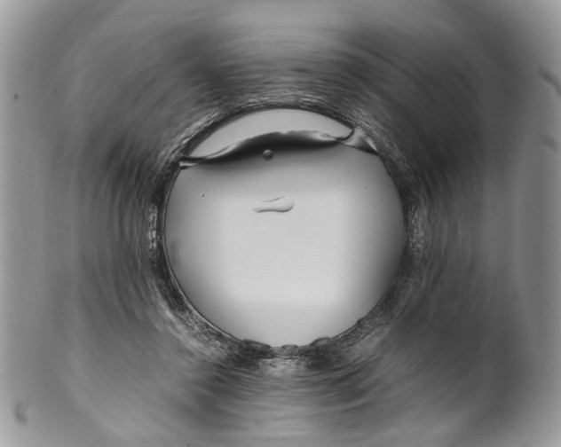 X0000099510356200806051152