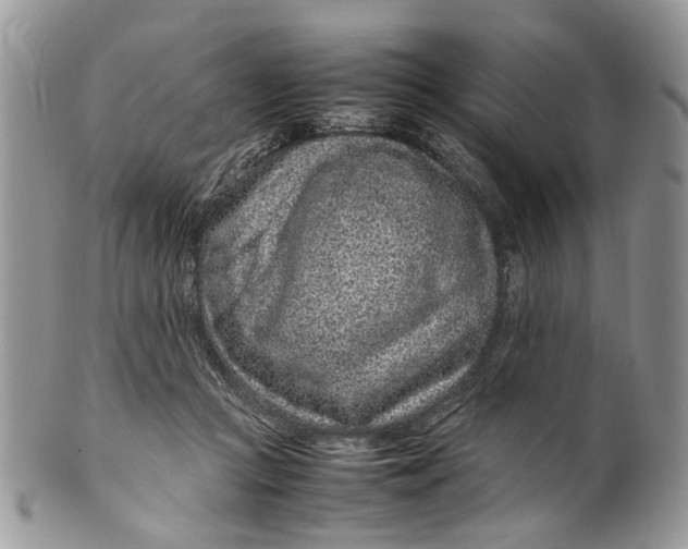 X0000099510361200806051152