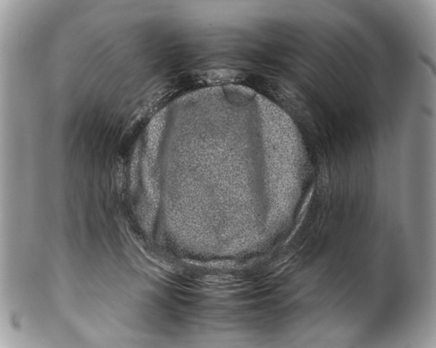 X0000099510367200806051153