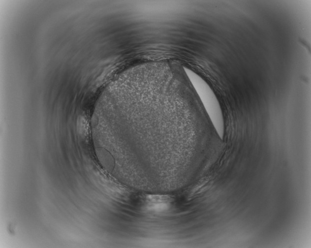 X0000099510371200806051153