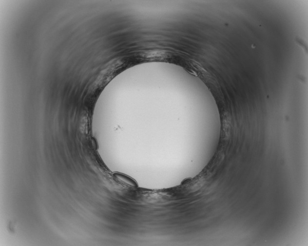 X0000099510379200806051153