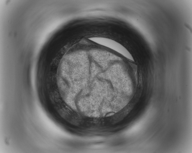 X0000099510383200806051153