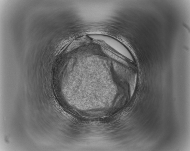 X0000099510385200806051152