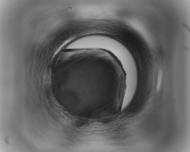 X0000099510387200806051152