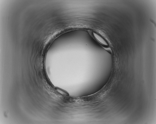 X0000099510395200806051152