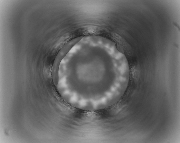 X0000099510423200806051152