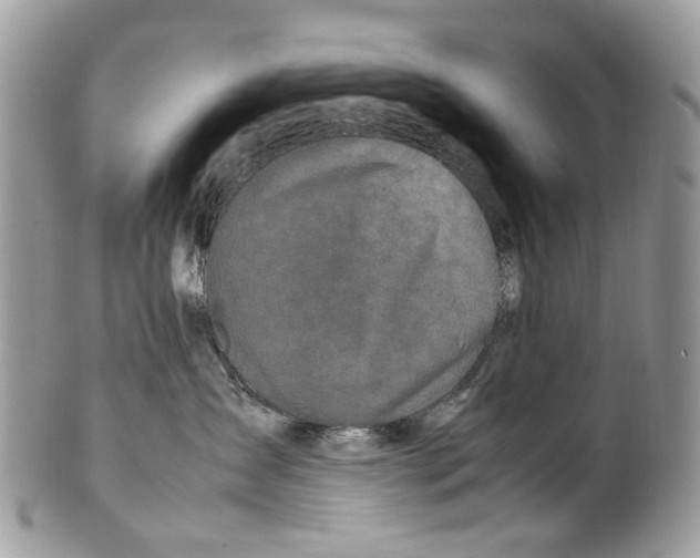 X0000099510431200806051151