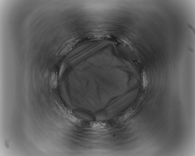 X0000099510471200806051151