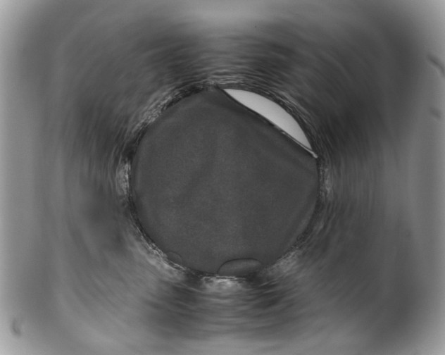 X0000099510475200806051151