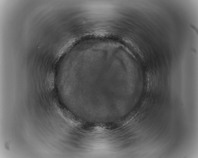 X0000099510496200806051150