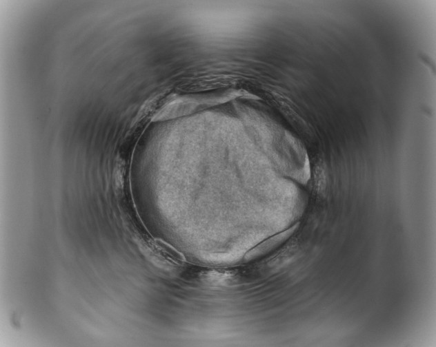 X0000099510570200806051150