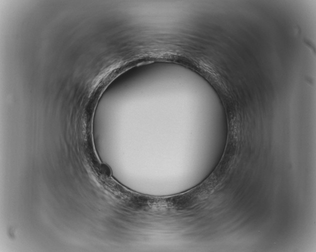 X0000099510587200806051149