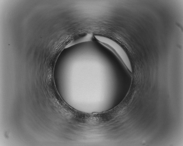 X0000099510593200806051149