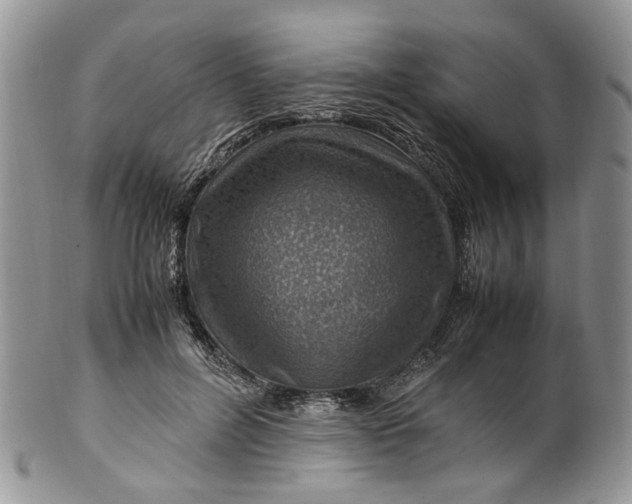 X0000099510600200806051148