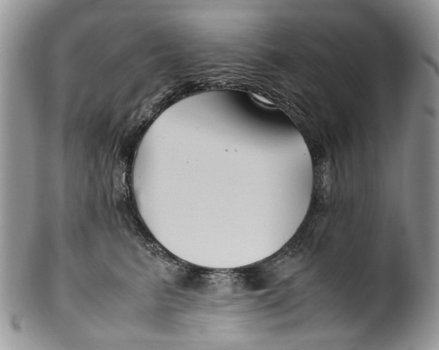 X0000099510615200806051148