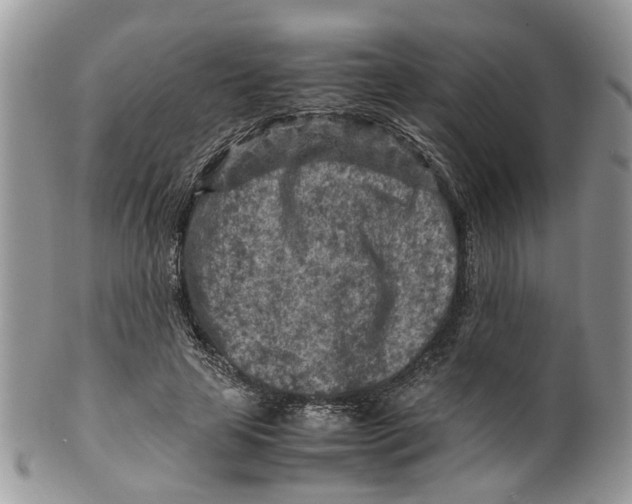 X0000099510641200806051148