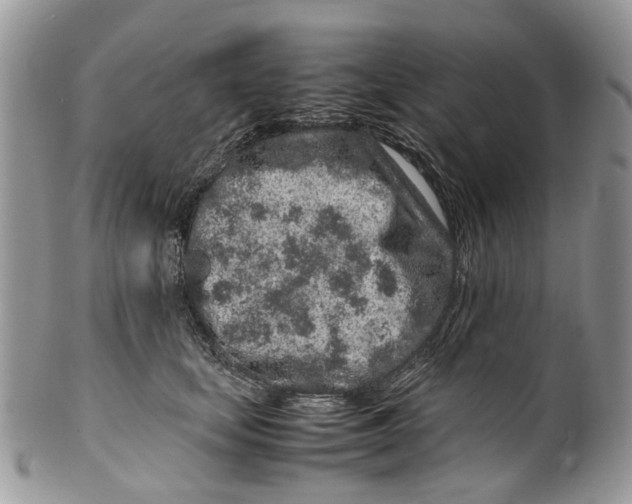 X0000099510659200806051148