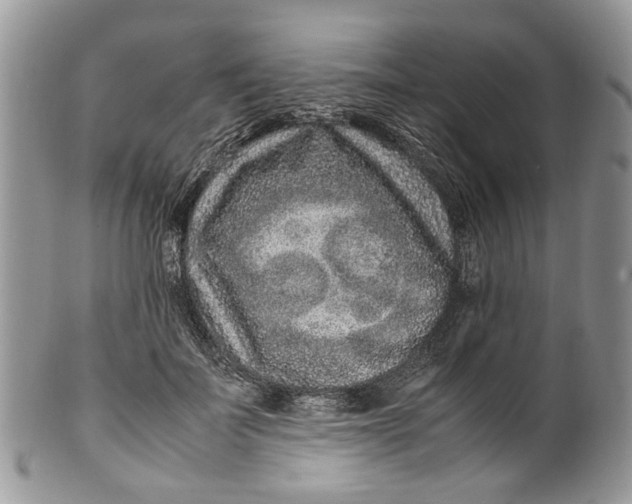 X0000099510699200806051147