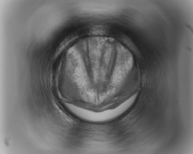 X0000099510722200806051146