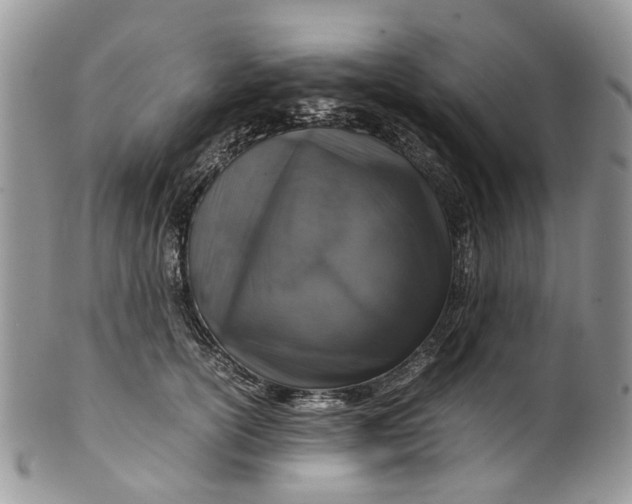 X0000099510754200806051147