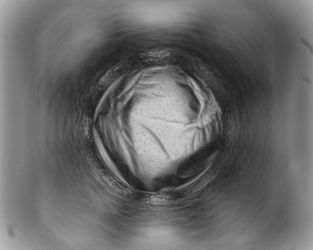 X0000099510758200806051147