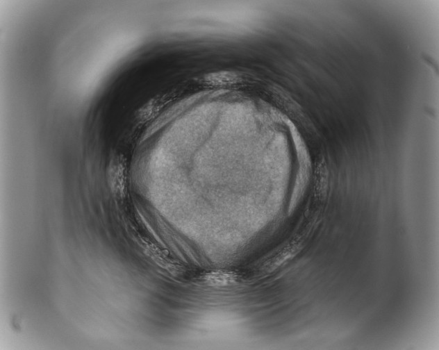 X0000099510762200806051147