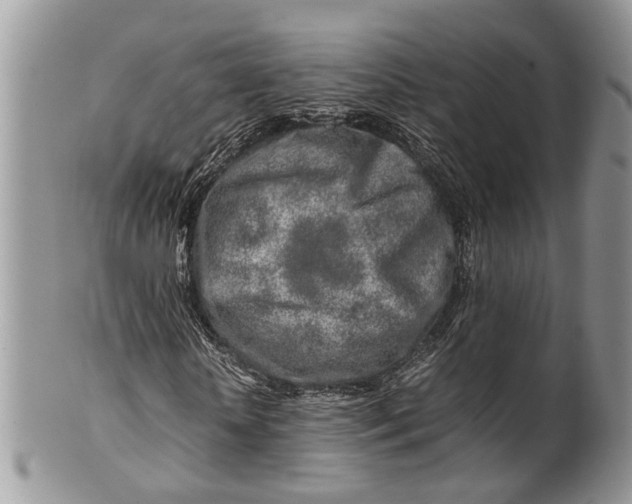 X0000099510818200806051145