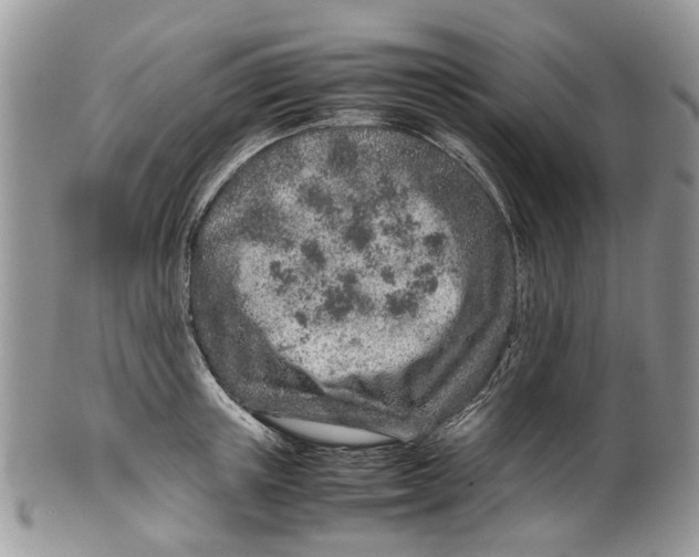 X0000099510851200806051145