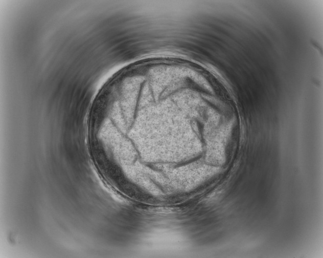 X0000099510862200806051145