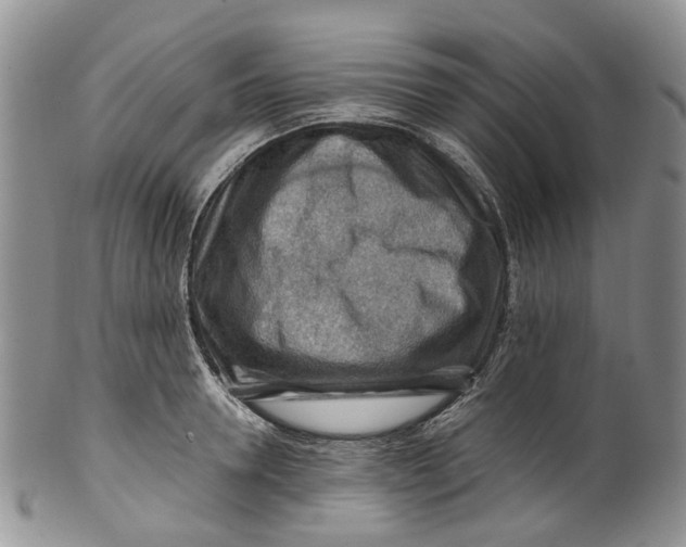 X0000099510946200806051144