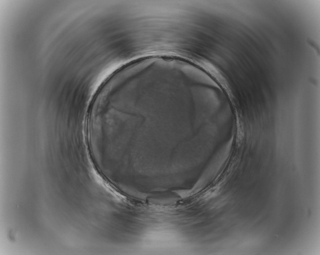 X0000099510958200806051144