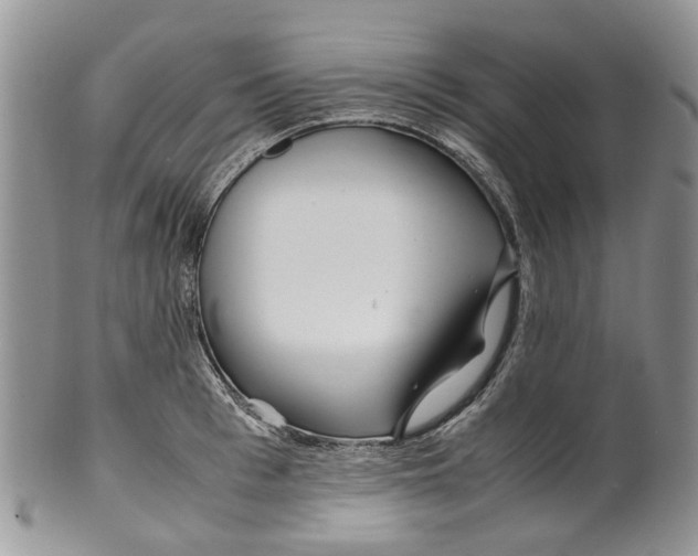 X0000099510993200806051143