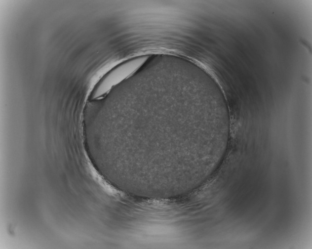 X0000099510995200806051143