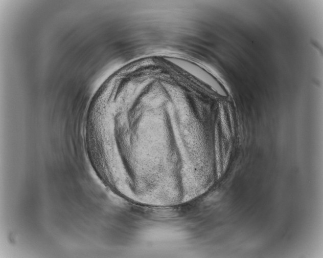 X0000099511007200806051142