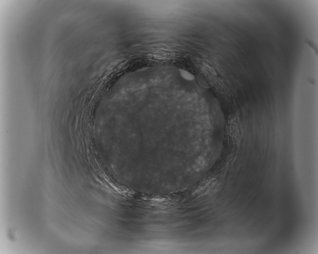 X0000099511009200806051142